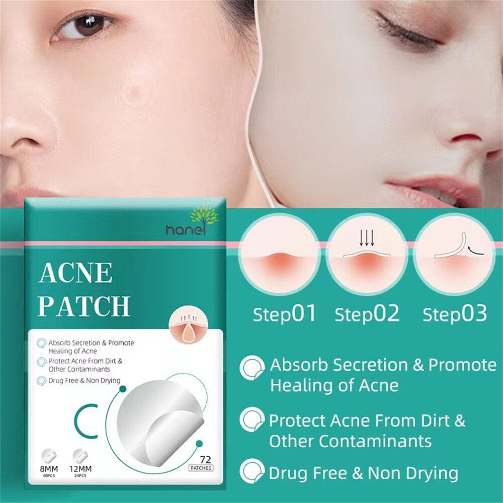 Acne Pimple Patch Blemish Spot Sticker Dots - Exopatch™️ - Pack Of 72 Patches Exopatch™️ - Pack Of 72 Patches Zaavio®