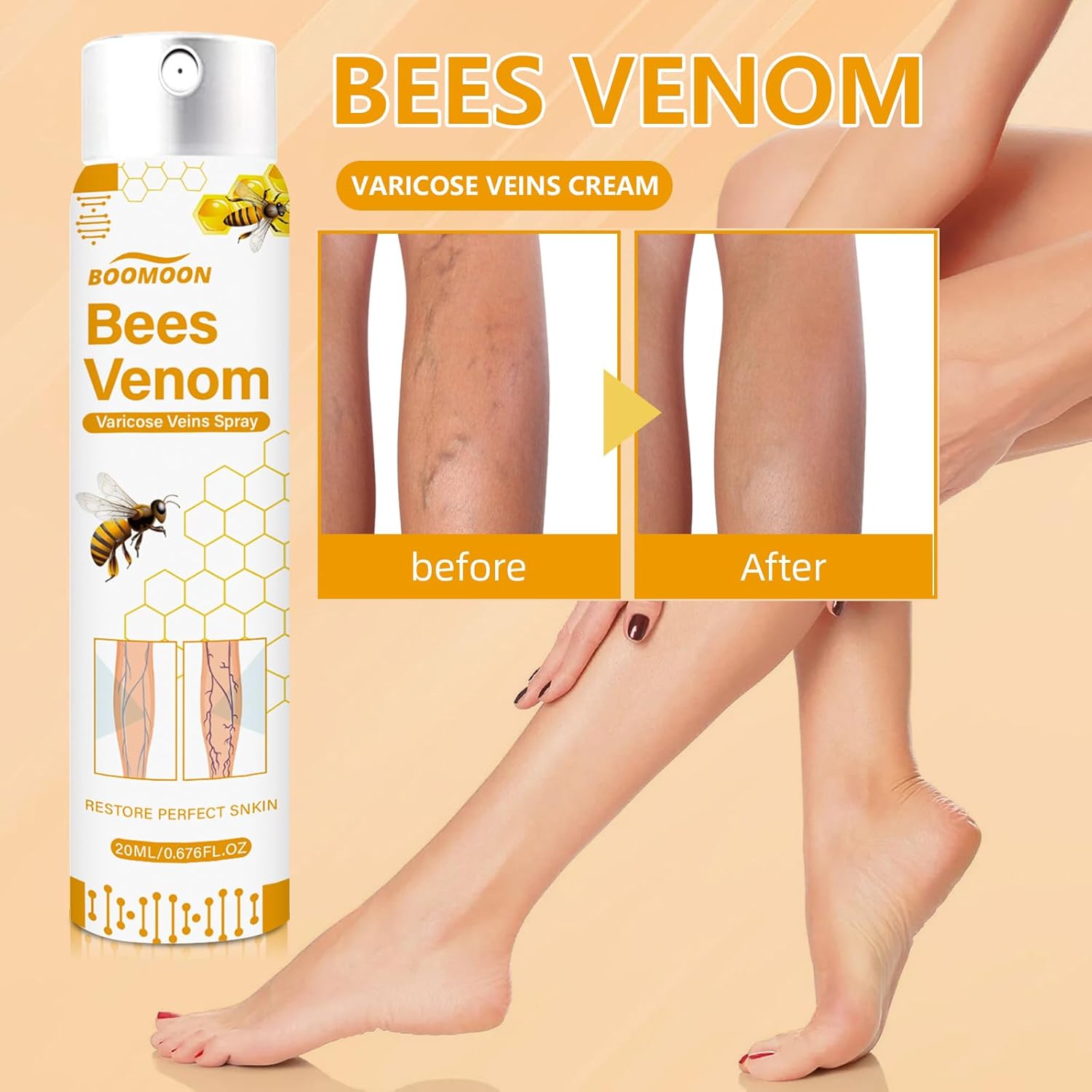 Bee Venom Varicose Veins Spray Bee Venom Varicose Veins Spray Zaavio®