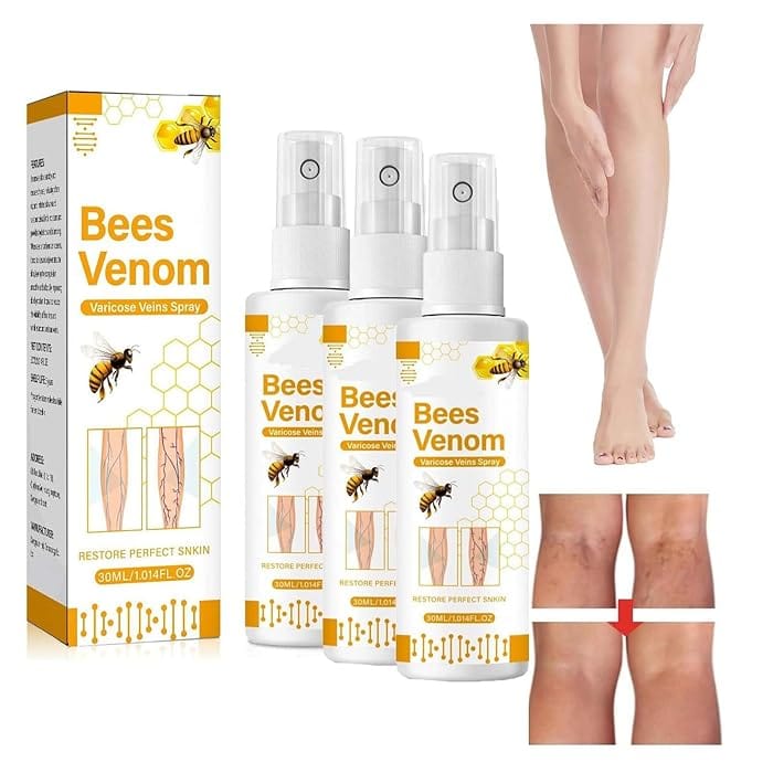 Bee Venom Varicose Veins Spray Bee Venom Varicose Veins Spray Zaavio®