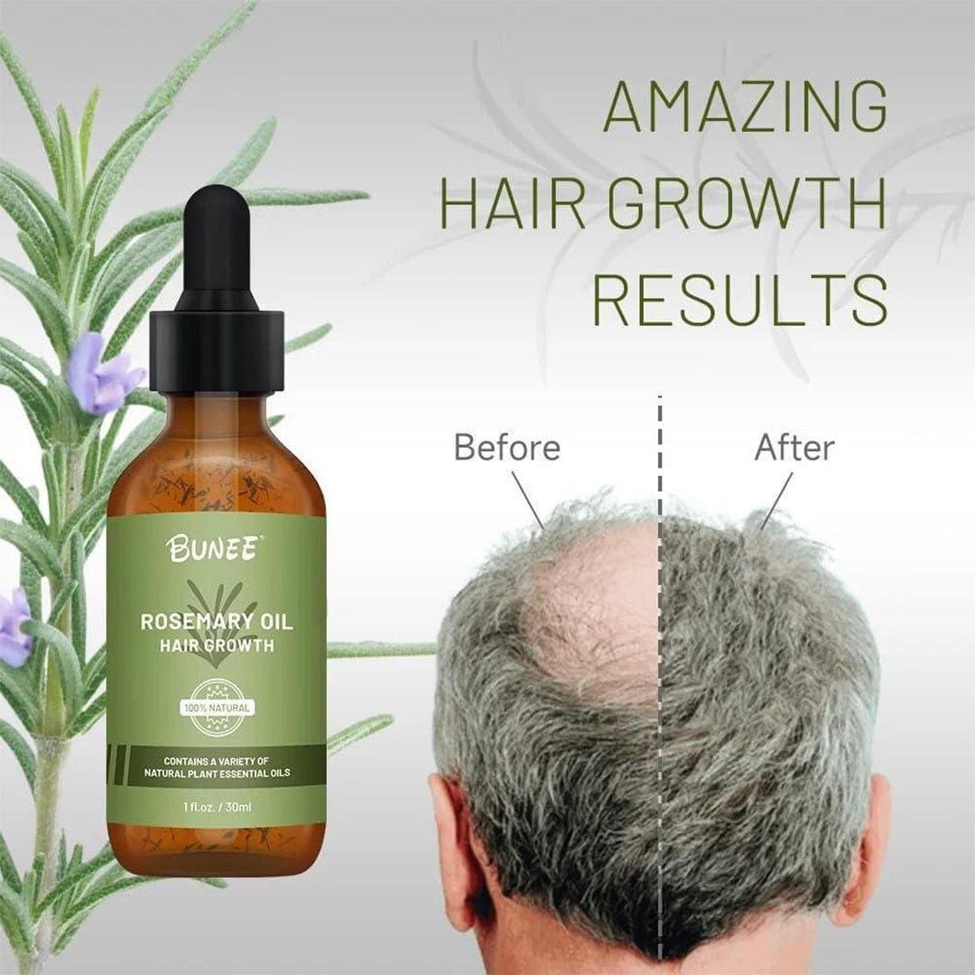 GrowGleam™️ Rosemary Hair Growth Serum Oil Zaavio®