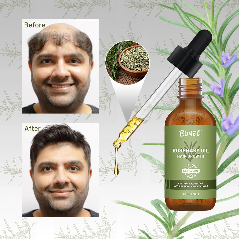 GrowGleam™️ Rosemary Hair Growth Serum Oil Zaavio®