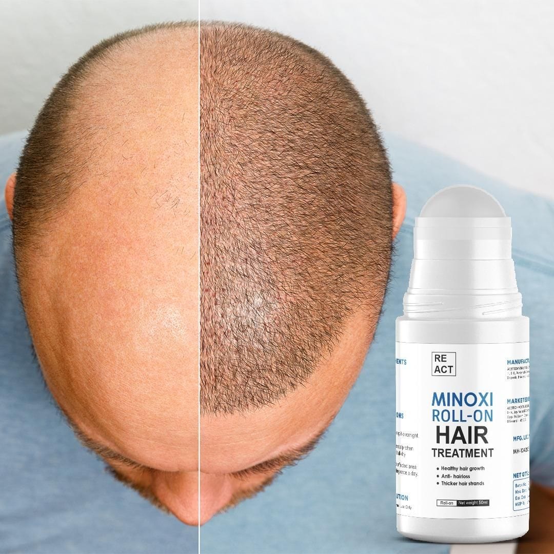 Hair Growth Serum Care Hair Solution Rolling for Regrow - RegrowRoll™️ (Pack of 2) RegrowRoll™️ (Pack of 2) Zaavio®