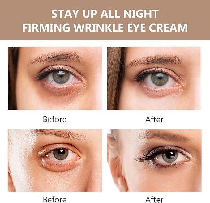 Instant Firm Eye Bag Cream  ORIGINAL™ Instant Firmx Eye Bag Cream Zaavio®