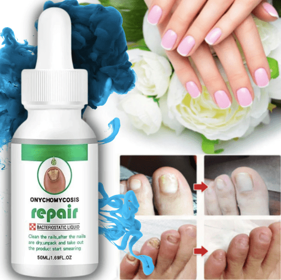 Kurizox™️ Nail Serum (Pack of 2) | Brittle Nails Grow Nail Manicure Transparent Serum Kurizox™️ Nail Serum (Pack of 2) Zaavio®