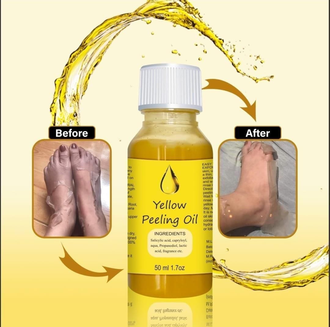 RadiateResplend™️| Peeling Oil for Skin (Pack of 2) | Skin-Care Body Oil Face Oil Body care Yellow Peeling Oil RadiateResplend™️ Peeling Oil for Skin (Pack of 2) Zaavio®