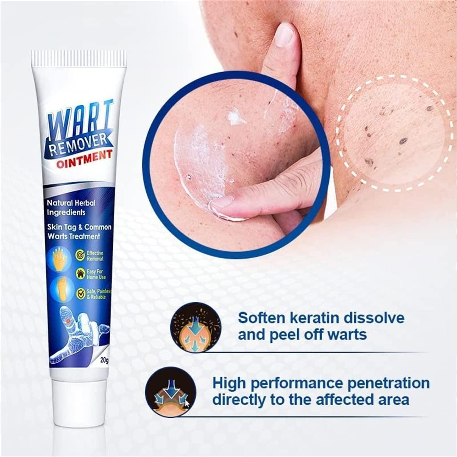 Salicylic Acid Wart Remover Black Head Removal Gel For Acne - Rejuvice™️ Rejuvice™️ Wart Remover Zaavio®