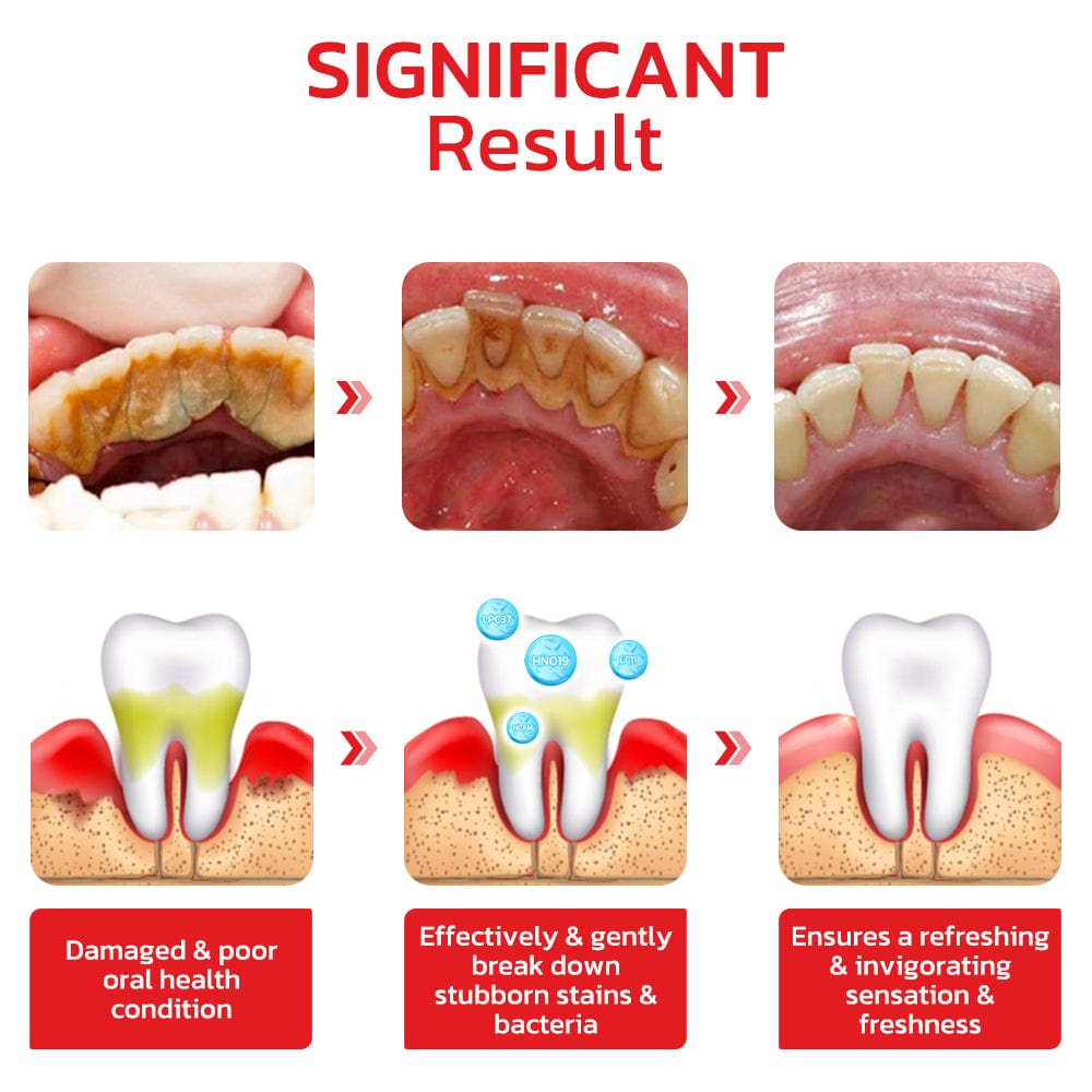 Teeth Whitening Tooth Paste Whitening Your Teeth At Home  - SP4 Probiotic Whitening Toothpaste SP-4 Probiotic Toothpaste Zaavio®