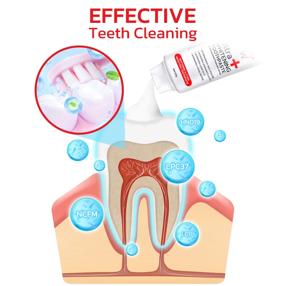 Teeth Whitening Tooth Paste Whitening Your Teeth At Home  - SP4 Probiotic Whitening Toothpaste SP-4 Probiotic Toothpaste Zaavio®