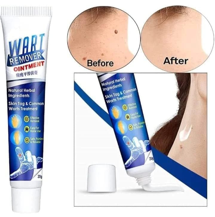 Wart Remover Instant Blemish Removal Cream Zaavio®