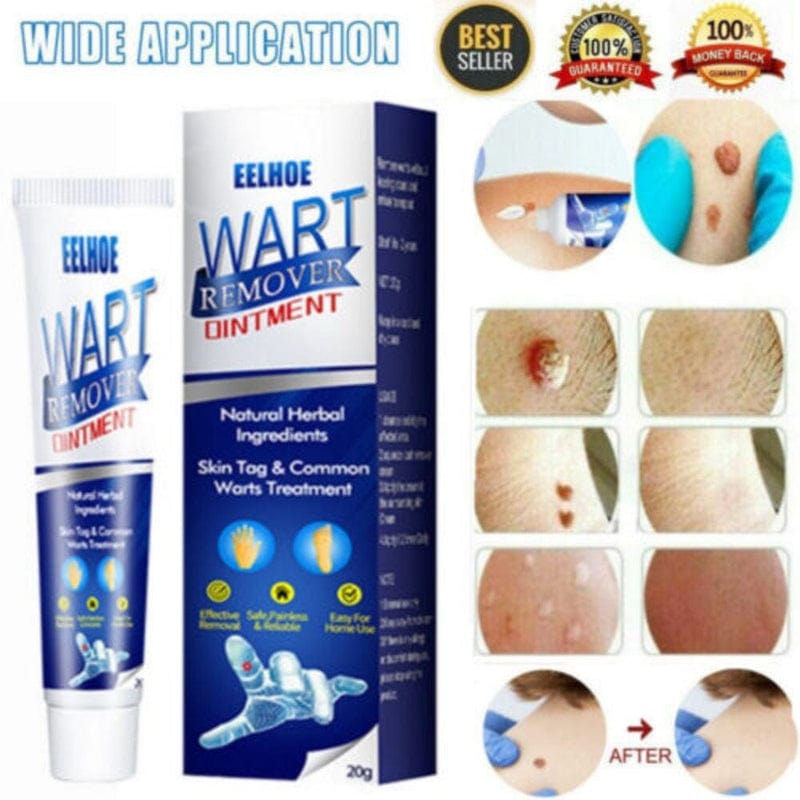 Wart Remover Ice Cream Mask Zaavio®